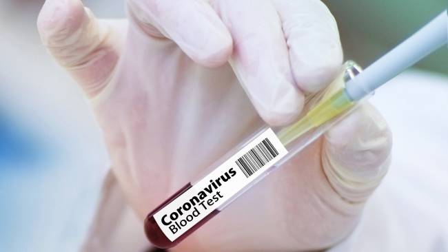 Tests sérologiques Covid-19 : comment ça marche ?
