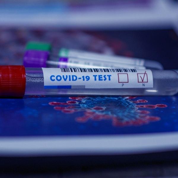COVID : quel test pour quoi ?